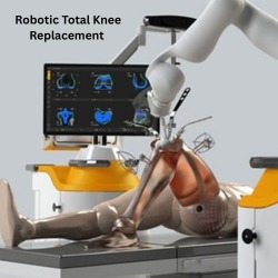 Robotic total knee replacement