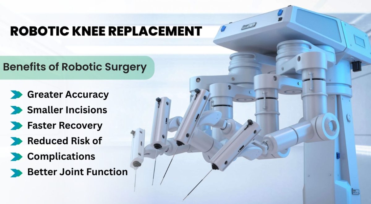Robotic Knee Replacement