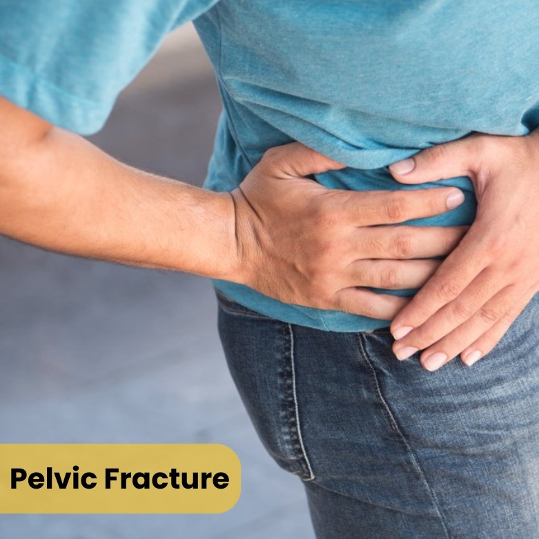 Pelvic Fracture