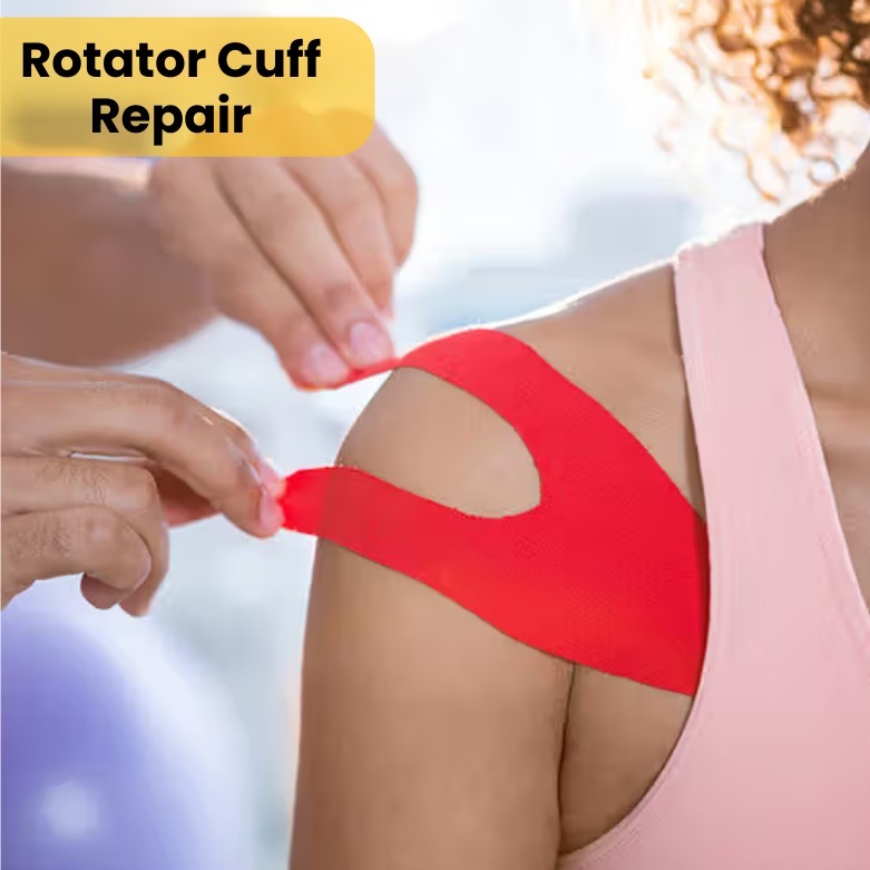 Rotator Cuff Repair