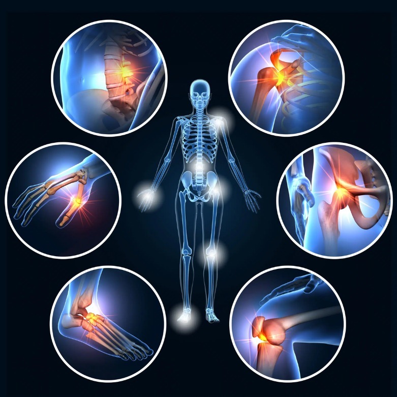 Orthopedic